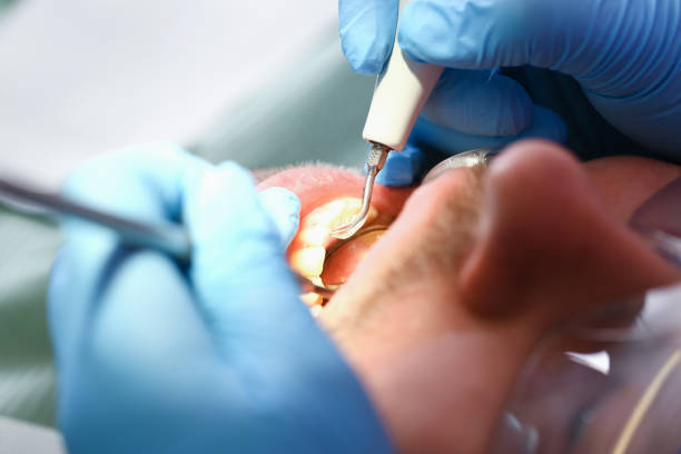 Best Cracked Tooth Emergency Dentist  in Bandon, OR